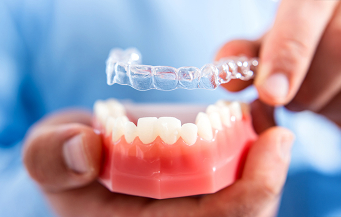 Doctor Fitting Clear Aligne To A Model