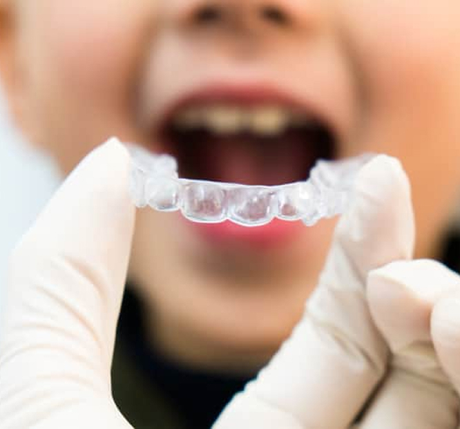 Orthodontist Placing Invisliagn Into Childs Mouth