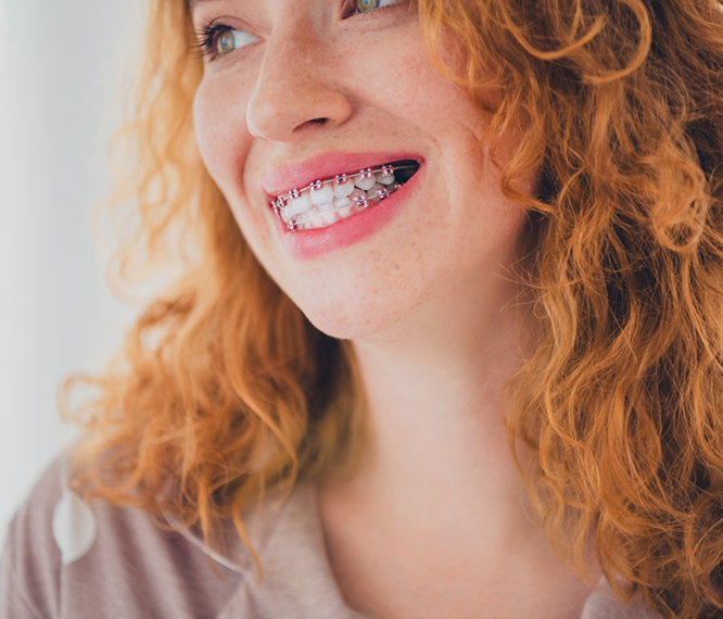Red Haired Teen With Braces Smaling And Looking To The Side
