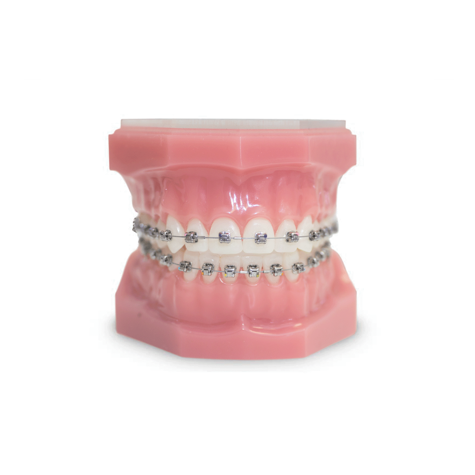 Damon Braces