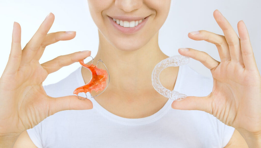 Orthodontic Retainers