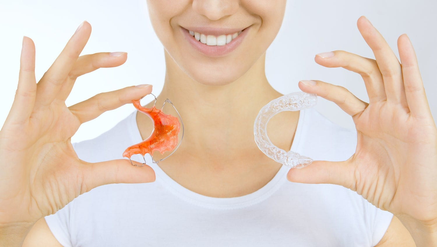 Orthodontic Retainers